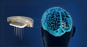 rendering of the Intracortical Visual Prosthesis (ICVP) wireless implantable stimulator model 