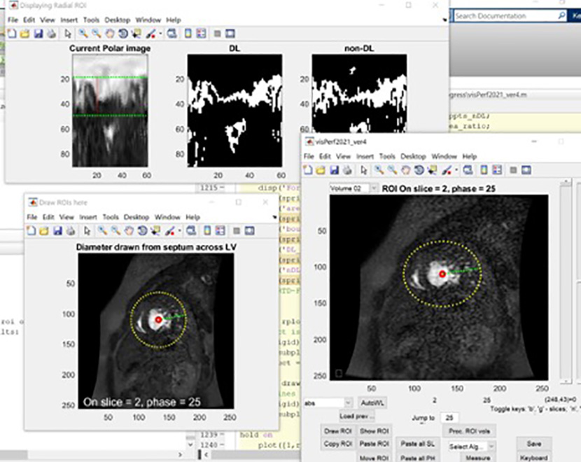Physician Operator Guidance Tool for Biomedical Image Processing using Matlab 2021